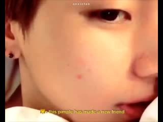 Everyone! this is my new friend "a pimple" it will stay with me for about a week please give it a lot of love #tae updates