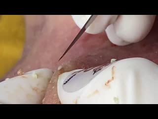 "тысяча выдавливаний", завершающий, 9 сезон, серия 2 из 4