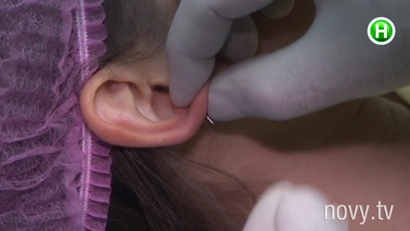 «проколола уши – получила букет инфекций» и все из за пистолета для проколов! абзац!