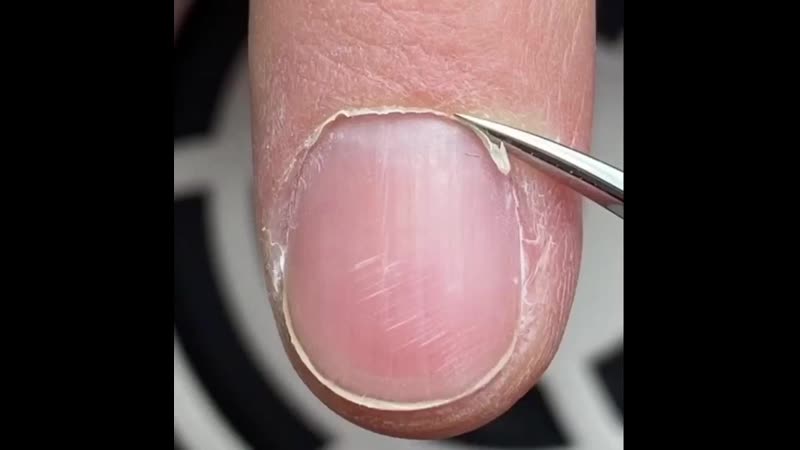 Как справляться со сложной кутикулой