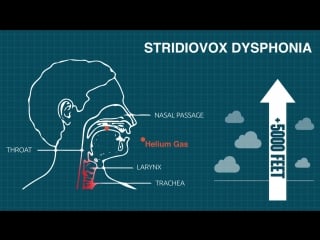 Blimp pilot gets chronic squeaky voice first australian to be diagnosed with stridiovox dysphonia