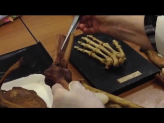 Локтевой и лучезапястный суставы articulatio cubiti et art radiocarpea