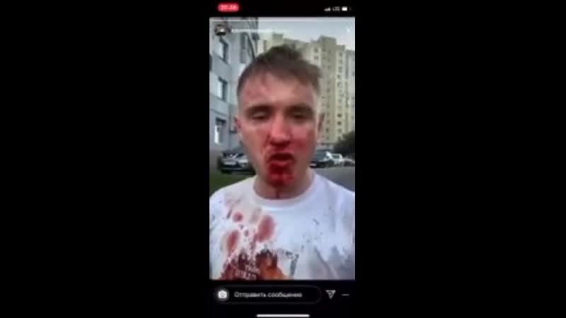 Чеченцы избили блогера святослав коваленко