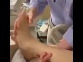 Гиперактивные рефлексы