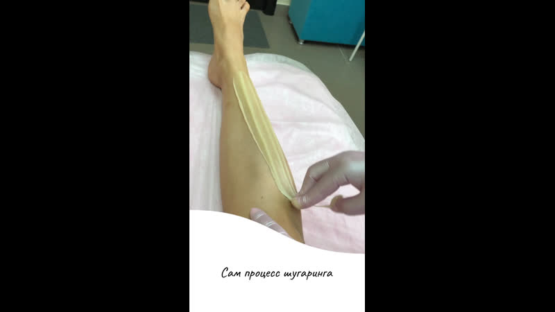 Шугаринг голени