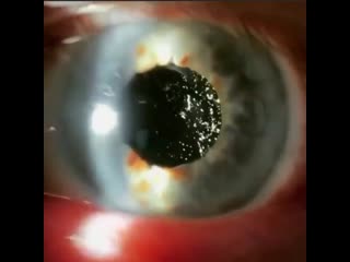 Астероид гиалоз