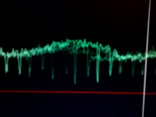 Видео от software defined radio | meteo