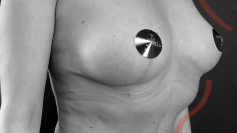 Комплексное преображение фигуры / пластический хирург кардов хазрит музаринович