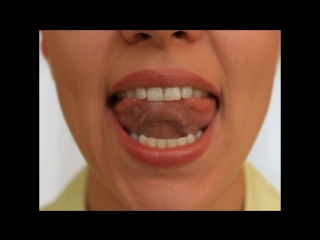 Артикуляционная гимнастика дятел