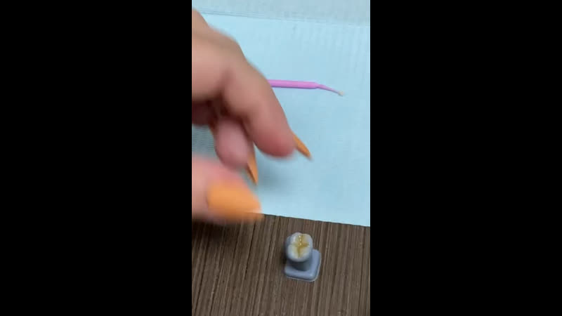 Реставрация зубов стоматология «доктор альбус», тюмень