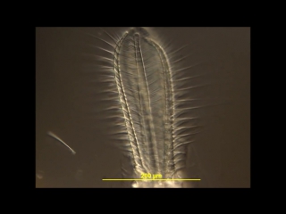 Stephanoceros fimbriatus a sessile predatory rotifer using a coronal basket for feeding