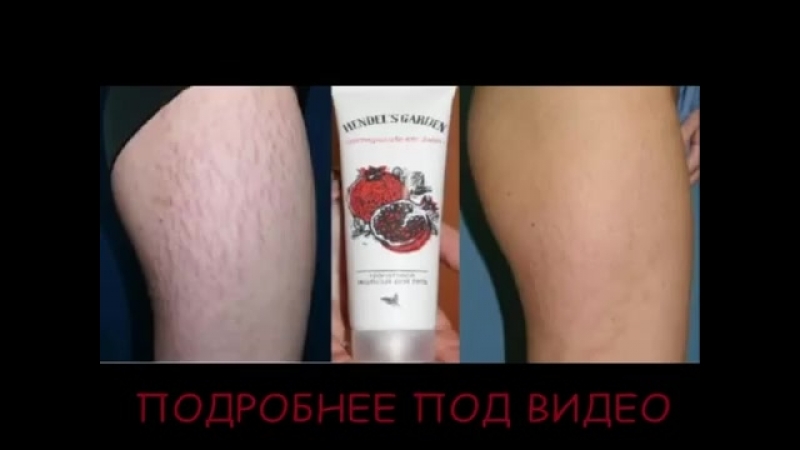 Гранатовая эмульсия от растяжек hendels