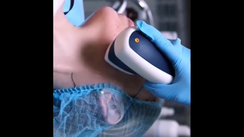 Лазерное диодное омоложение применяется даже летом!!