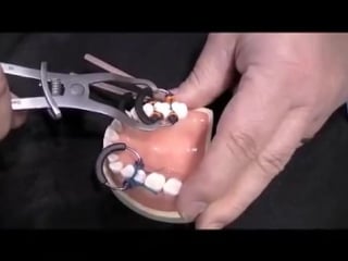 Garrison dental solutions matrix system стоматология матрицы