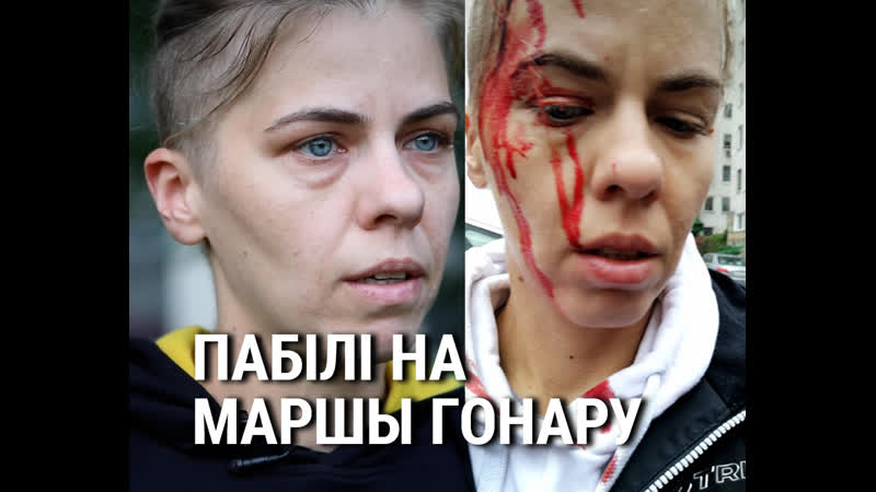 «гэта было з за сьпіны» амап разьбіў ганне галаву