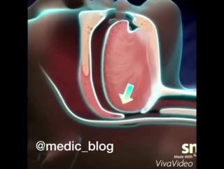 Храп возникает из за того что