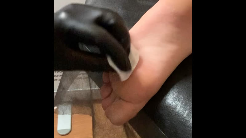 Удаление подошвенной бородаи