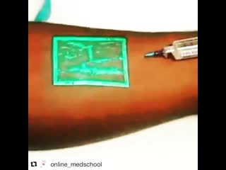 Интересные медицинские технологии