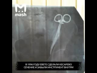 Женщина из осетии 23 года ходила с ножницами в молодые