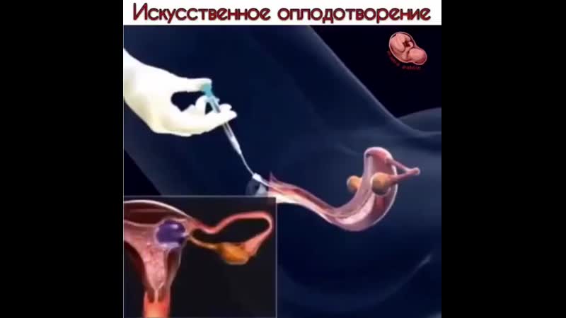 Искусственное