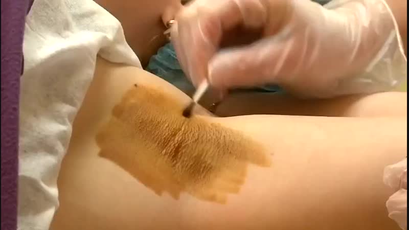 Merged гипер гипер гипер mp4