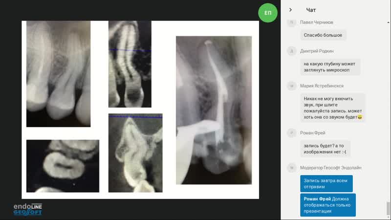 Вебинар евгения платонова "альтернатива в обработке корневых каналов зуба"