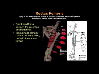 Mri hip anatomy (vumedi) by dr jean jose