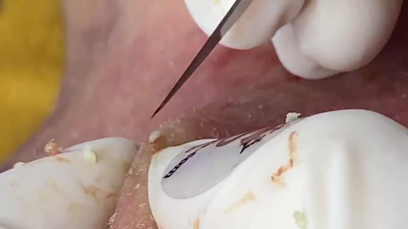 "тысяча выдавливаний", завершающий, 9 сезон, серия 2 из 4