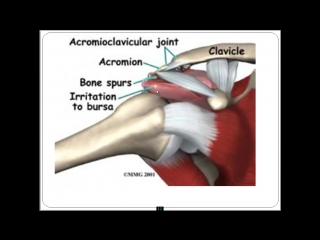 Плечевой сустав строение, функционирование, проблемы, решения