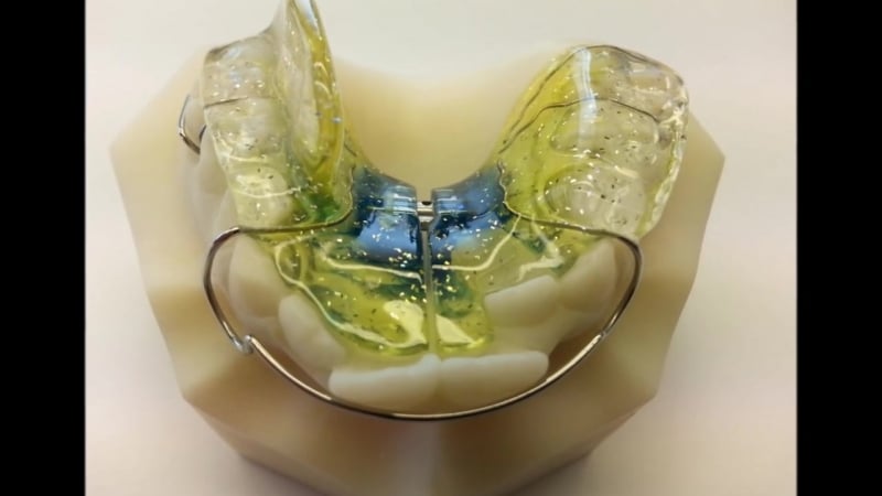 Съемные аппараты ортодонтическая лаборатория ortho rem италия