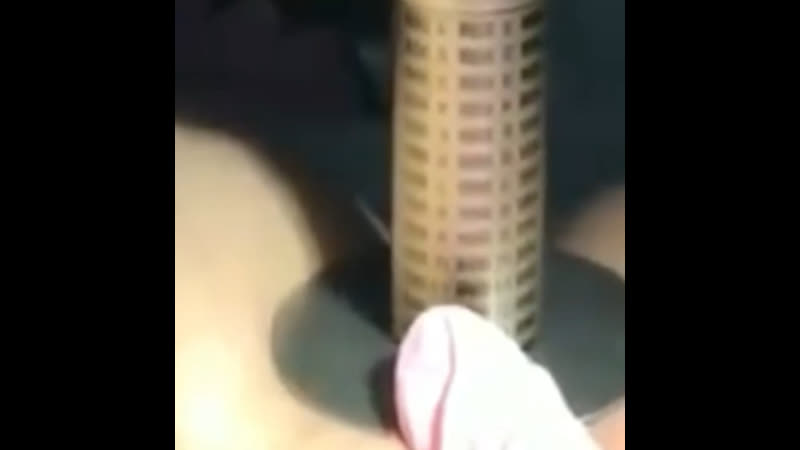 Лазерное омоложение влагалища 20%