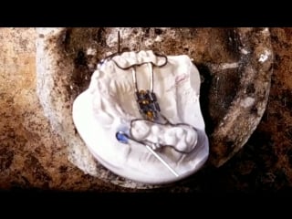 Orthodontic lab lesson adding facemask hooks by szara dental зуботехническая работа ортодонтия