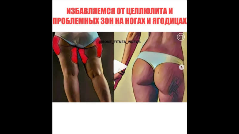 Избавляемся от целлюлита!