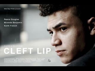 Заячья губа cleft lip (2018) великобритания