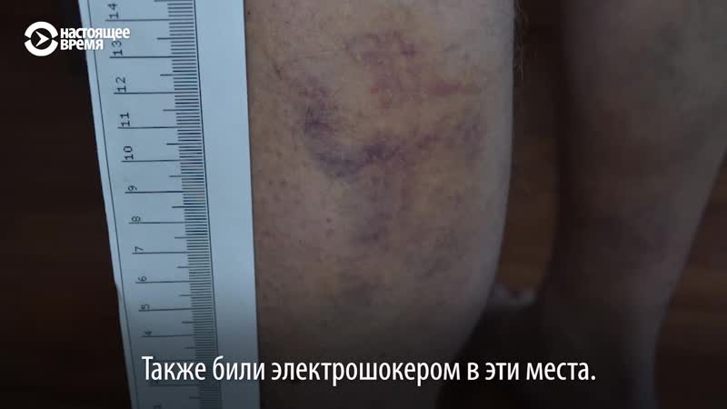 Свидетели иеговы из сургута показали следы пыток