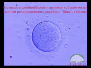 Оплодотворение in vitro (ivf)