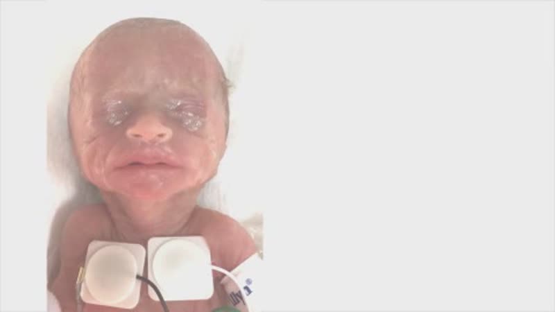 Героические приключения тру бир в реанимации