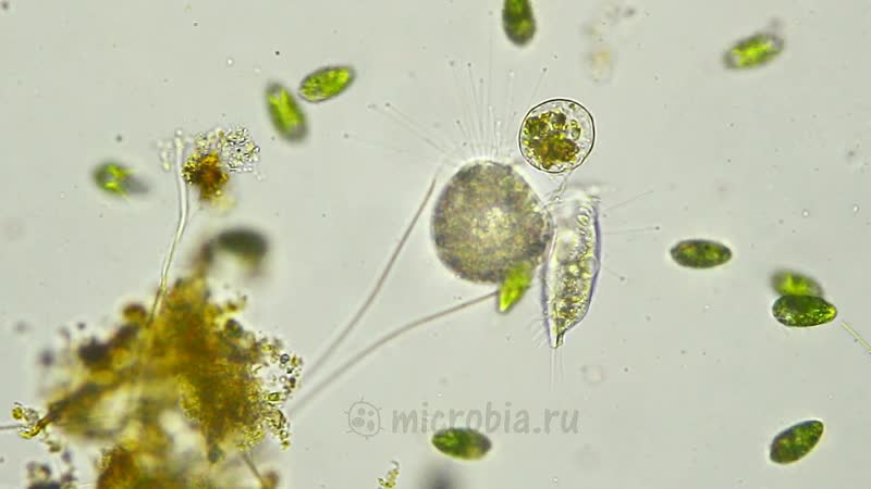 Сосущая инфузория metacineta, 400х