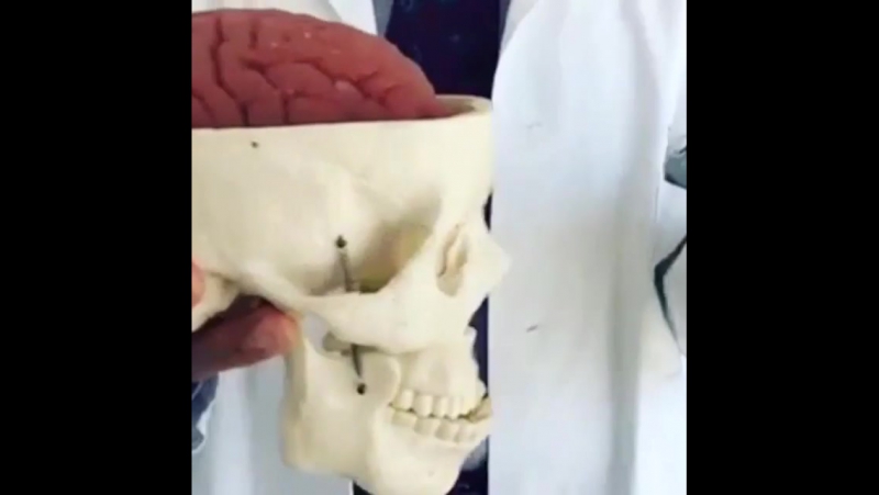 Вот что происходит с мозгом во время сильного сотрясения