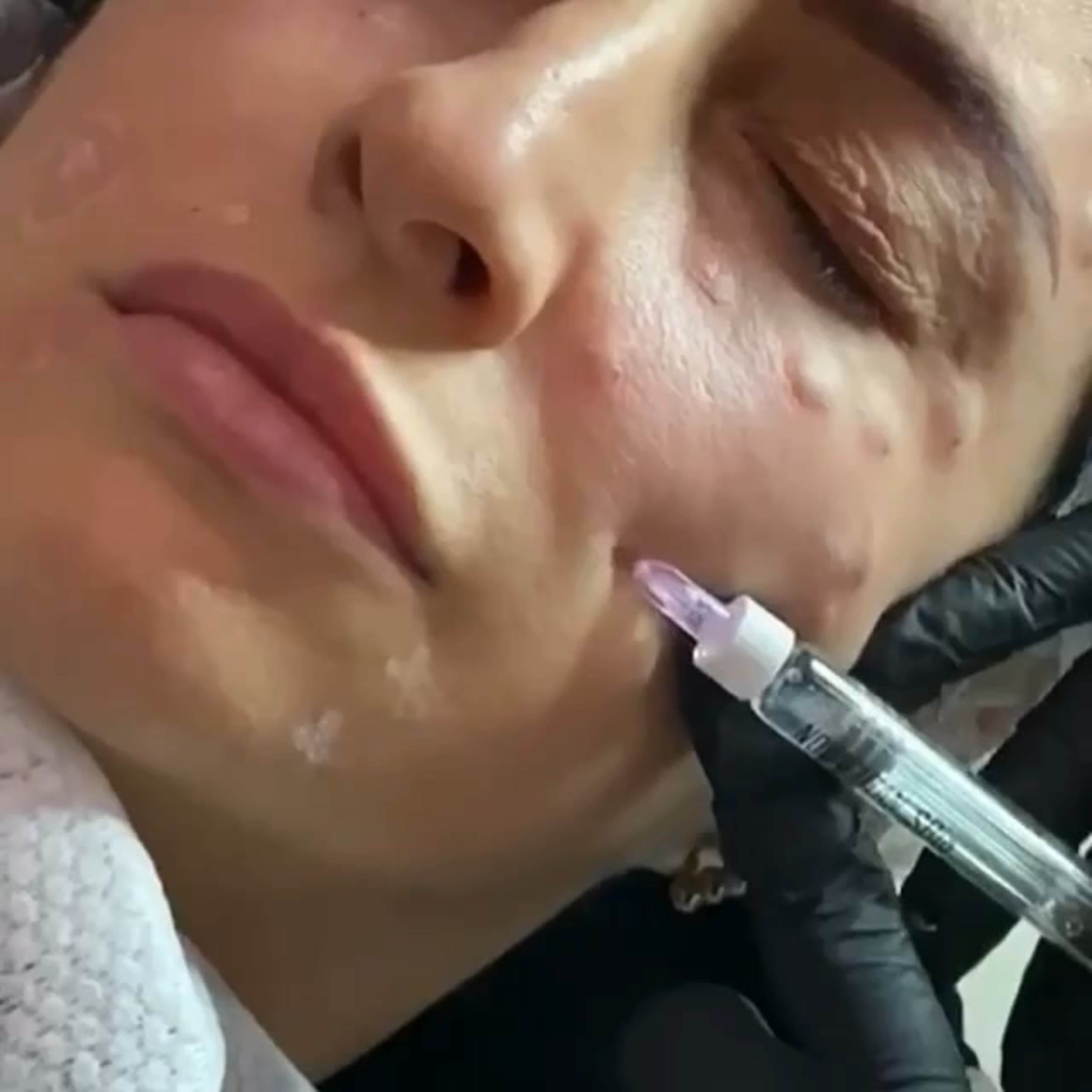 Видео от luiza cosmetolog watch online