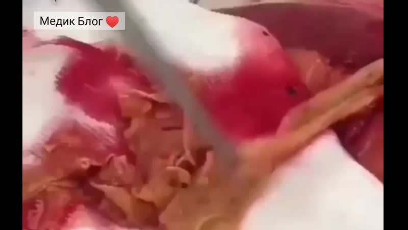 Свиной цепень 🦠