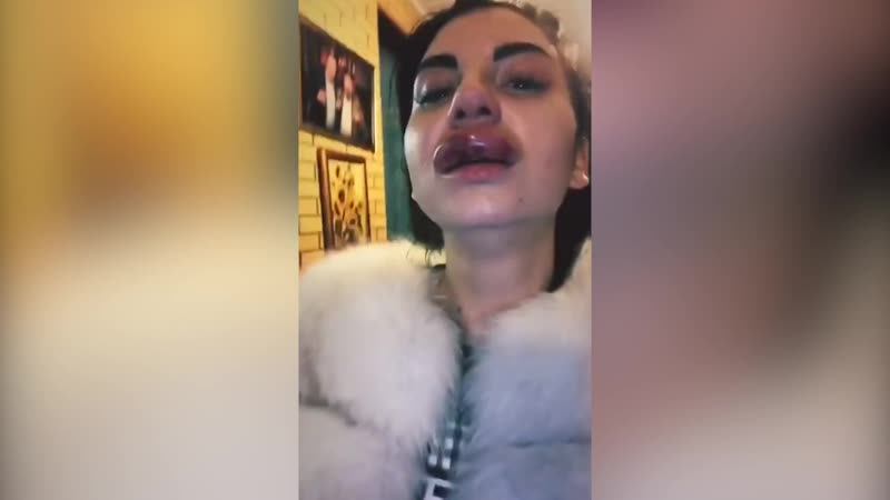 Огромная губа