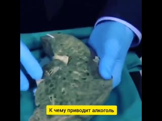 Последствия употребления алкоголя