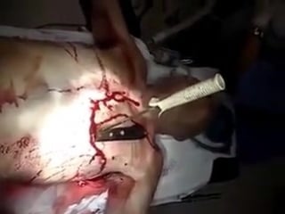 Man stabbing chest knife file mp4