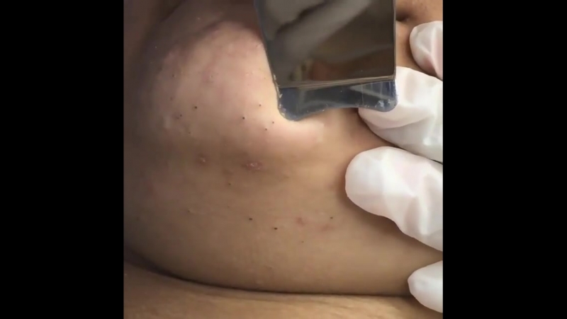 Хороший скребок ультразвуковая чистка?