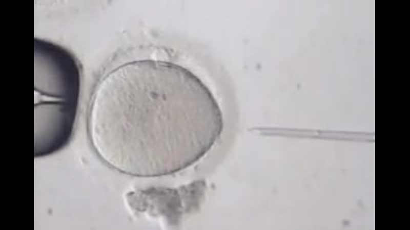 Эко экстракорпоральное оплодотворение