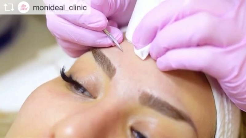 Инновационная процедура phformula