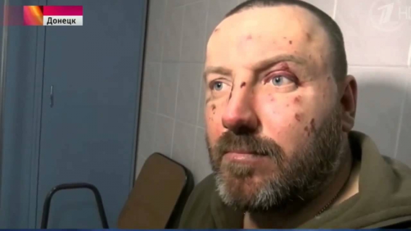 Ополченцы оказали медпомощь раненым пленным укропам