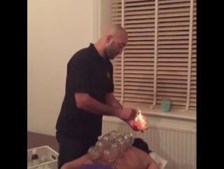 Chinese fire cupping therapy