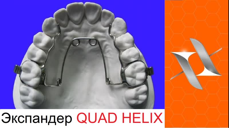 Ортодонтический аппарат квадхеликс оrthodontic appliance quad helix